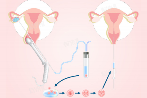 地中海贫血夫妇能否通过一代试管技术避免遗传