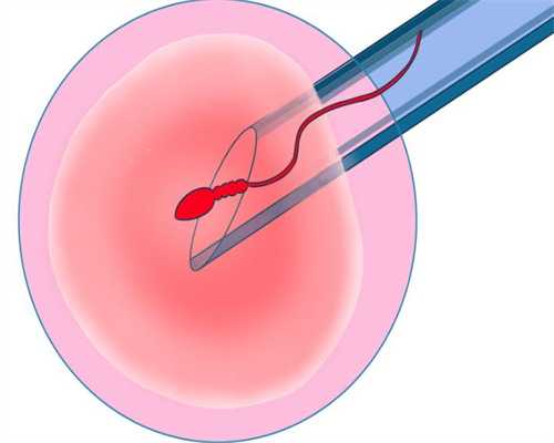 婴儿飞机抱的正确方法与禁忌：代生专家分享安全技巧