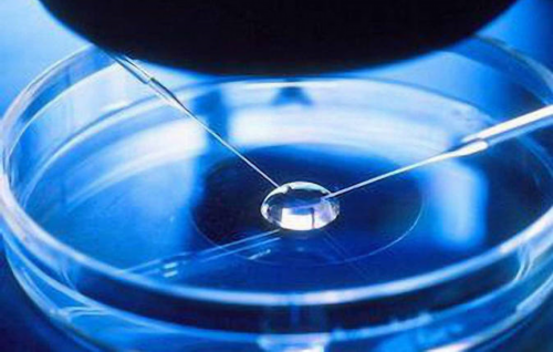 子宫肌瘤试管婴儿费用明细与影响因素解析