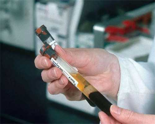 石嘴山试管婴儿费用明细与代怀套餐解析