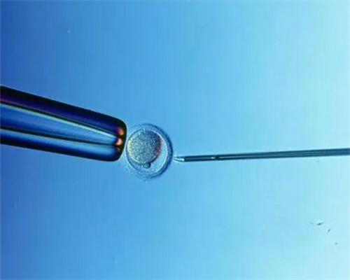 输卵管堵塞对试管受孕率与宫外孕风险的影响分析